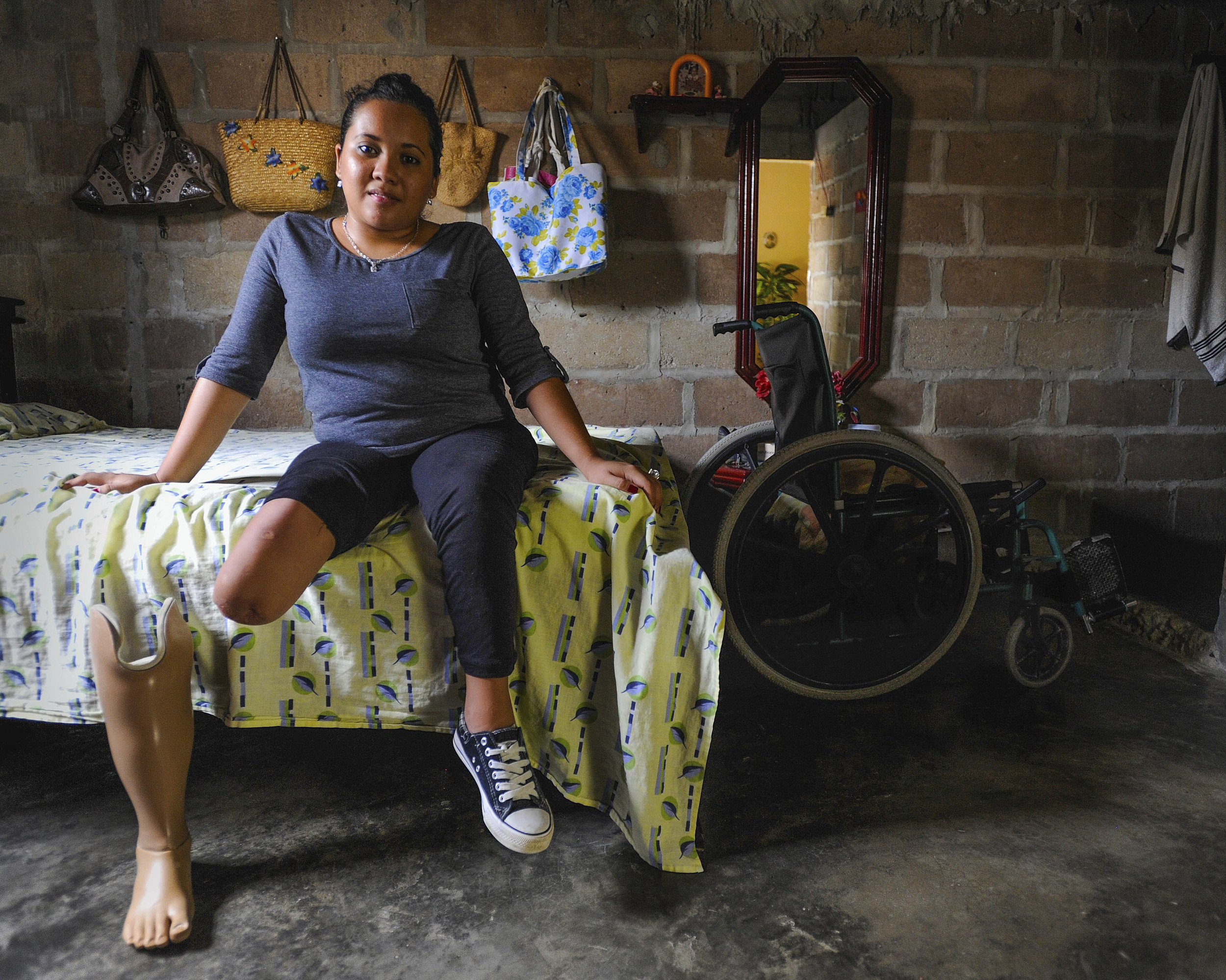 Loraine Pastrana, 17, who lost her leg to an infection at age 12, studies for a career in medical billing in her native Colombia.