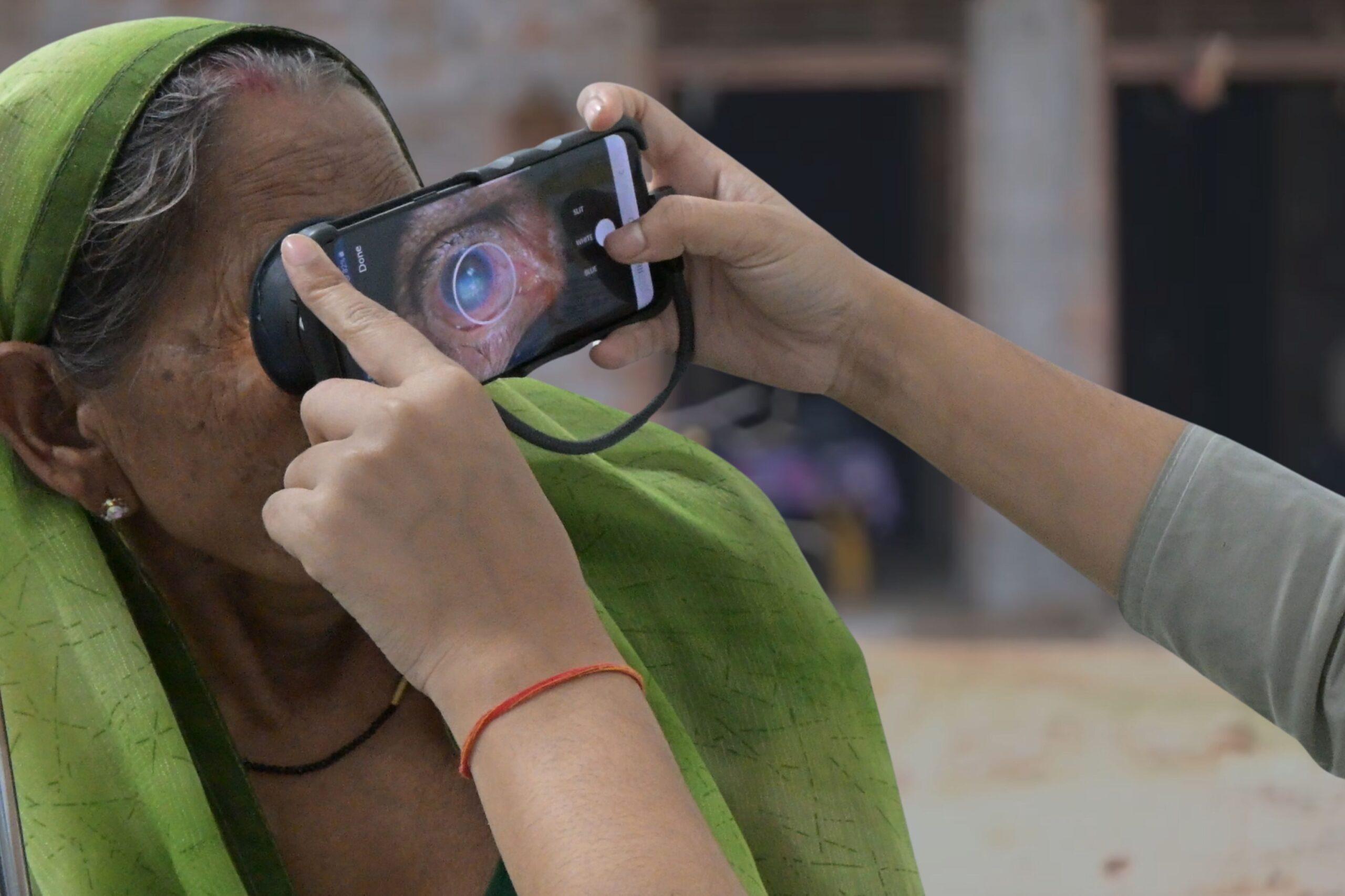 A healthcare provider uses Visilant’s Seeker smartphone eye imaging device that captures clinical-grade eye images in Chitrakoot, Uttar Pradesh, India. An AI system then analyzes the images and patient history to diagnose conditions like cataracts and infections with near-clinical accuracy.