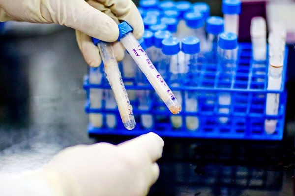 Amfar Makes $100-Million Push for an End to AIDS by 2020